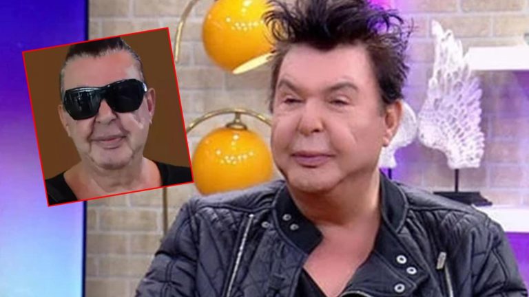 Yüzünü gerdiren Kuşum Aydın’ın şişlikleri indi! Görenler aynı yorumu yaptı